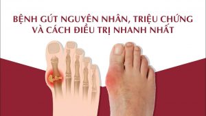 Bệnh Gút