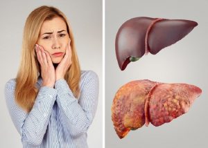 Khi nào cần giải độc cơ thể?