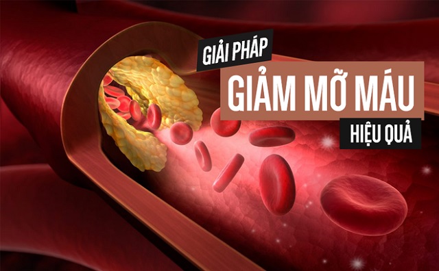 Cải thiện tình trạng mỡ thừa và giảm chỉ số cholesterol trong máu Nước hydrogen, Nước hydrogen là gì? Máy lọc nước hydrogen có tốt không?, Nhà phân phối máy lọc nước ion kiềm số 1 Việt Nam | Vitamia