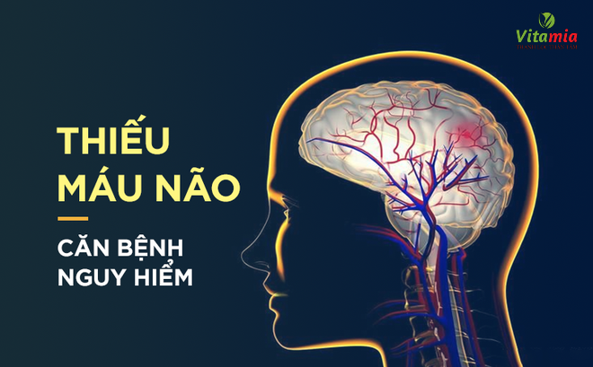 Thiếu Mãu Não Là Gì? Thiếu Máu Não Uống Nước Gì để Cải Thiện