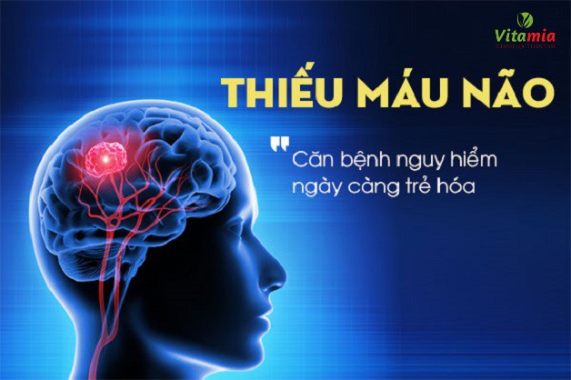 Thiếu máu não là gì?
