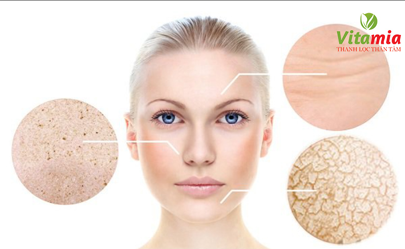 Cách chăm sóc da mùa đông