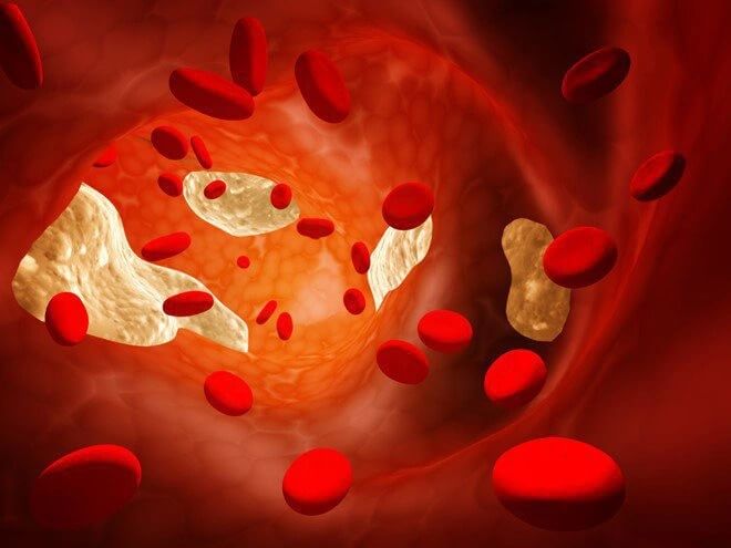 Than hoạt tính có tác dụng gì: Có thể làm giảm mức cholesterol máu